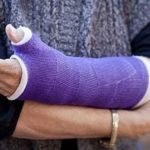 New Jersey Slip & Fall Broken Arm